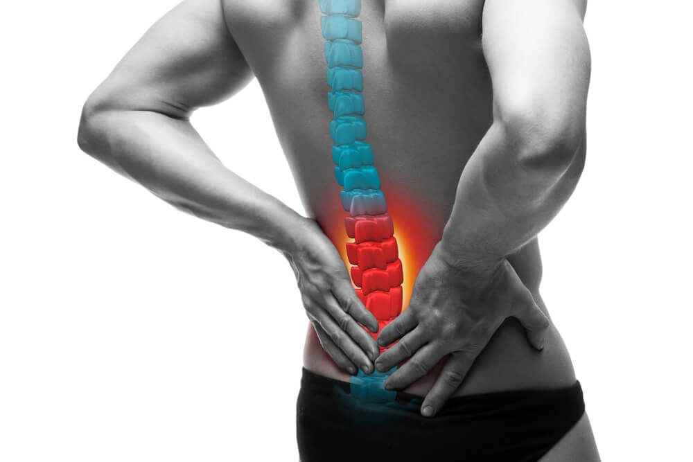 Medical illustration of a man having a spinal disc problem.