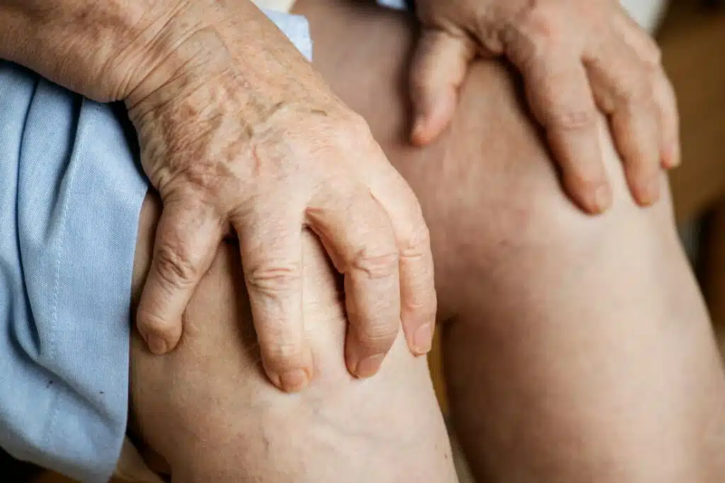 elderly woman suffers from Arthritis.